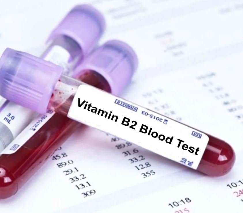 Витамин B2 - Сеть клиник АО Семейный доктор (Москва) - Изображение 1
