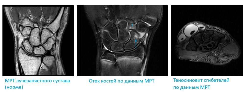 МРТ лучезапястного сустава - Сеть клиник АО Семейный доктор (Москва) - Изображение 1