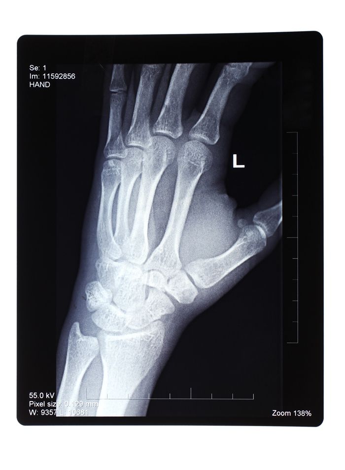 Рентгенография лучезапястного сустава - Сеть клиник АО Семейный доктор (Москва) - Фото 1