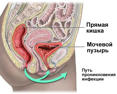 Мочевой Пузырь Фото У Женщин