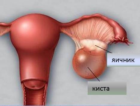 Где Находится Киста Фото