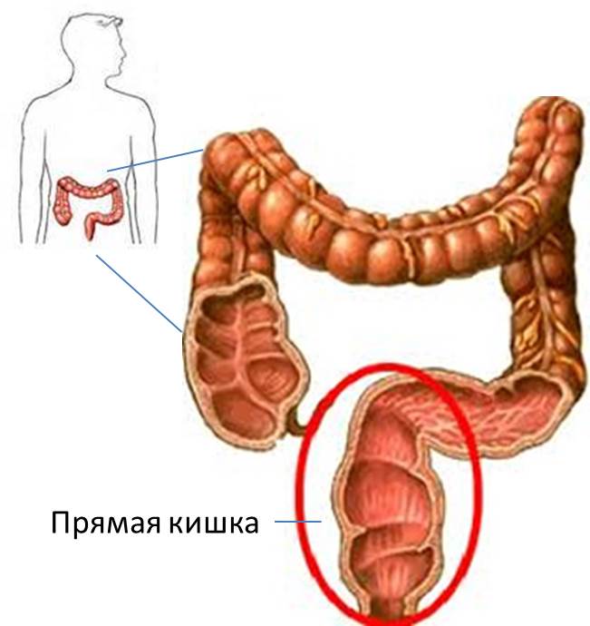 Неправильный стул и кровянистые выделения