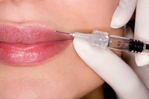 Изображение 1: Коррекция и увеличение объёма губ - клиника Семейный доктор