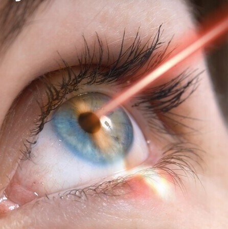 Амбулаторная хирургия глаза