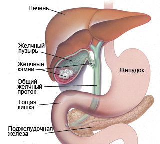 Желчекаменная болезнь (cholelithiasis): симптомы, причины и лечение