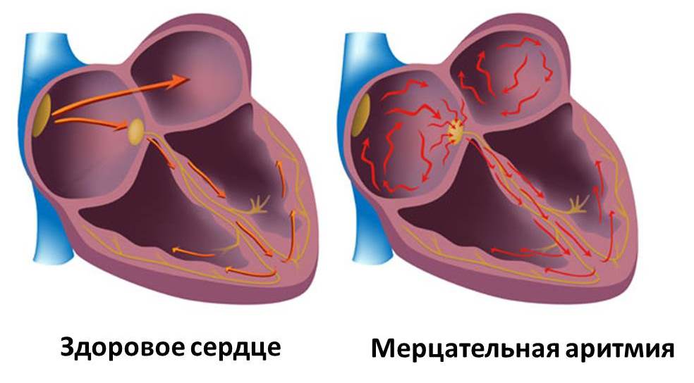 Изображение 1: Аритмия - клиника Семейный доктор