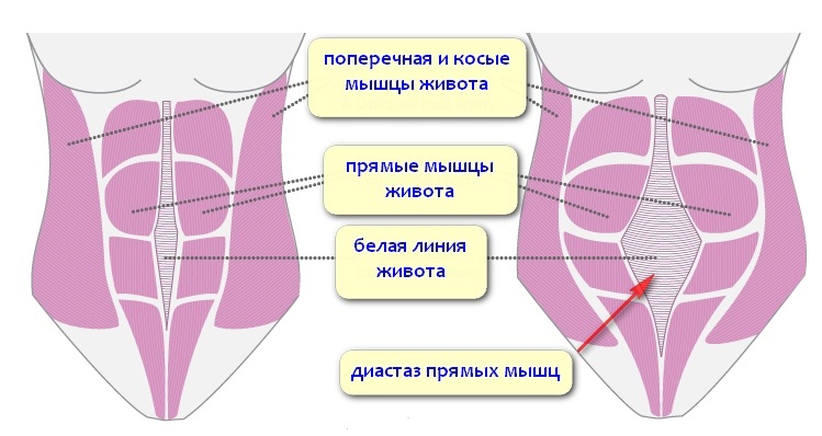 Изображение 7: Грыжа живота - клиника Семейный доктор