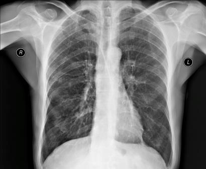 Изображение 1: Рентгенография грудной клетки - клиника Семейный доктор