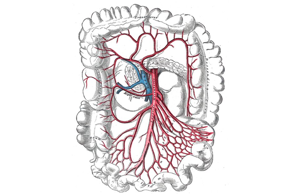 Заболевание мезентериальных артерий
