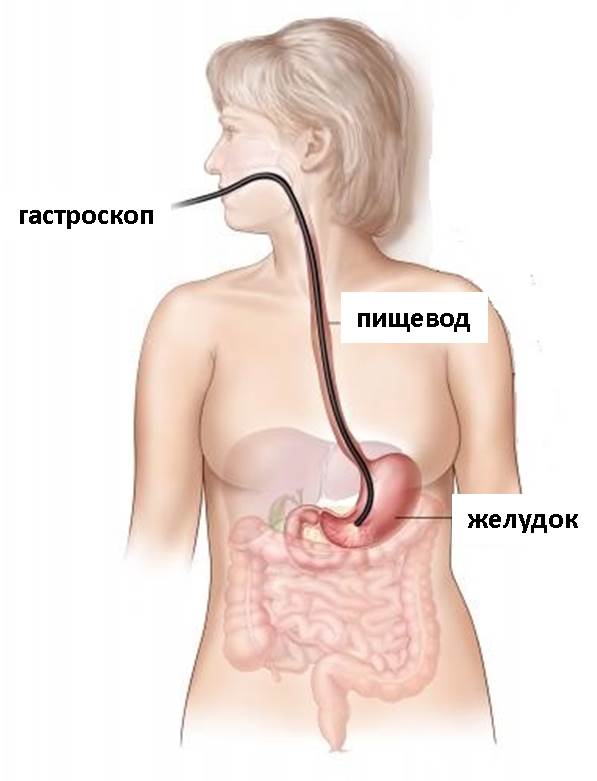 Изображение 1: Гастроскопия – клиника Семейный доктор