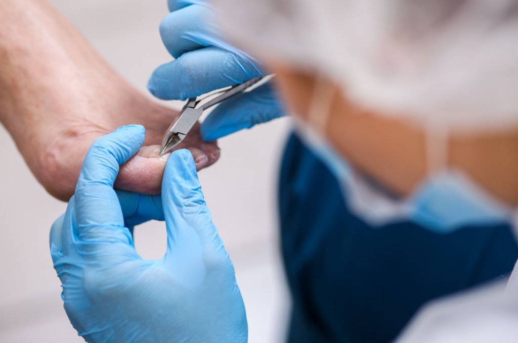 Вросший ноготь - Сеть клиник АО Семейный доктор (Москва) - Изображение 1