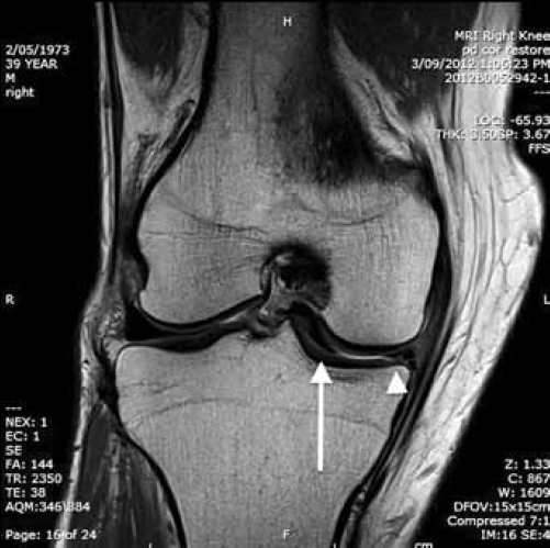 МРТ коленного сустава - Сеть клиник Семейный доктор (Москва) - Изображение 1