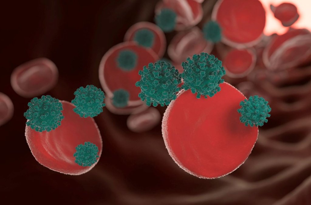 Сепсис - Сеть клиник АО Семейный доктор (Москва) - Изображение 1