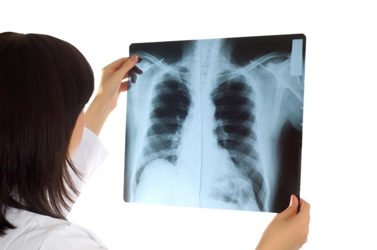 Рентген грудной клетки - Сеть клиник АО Семейный доктор - Фото 1