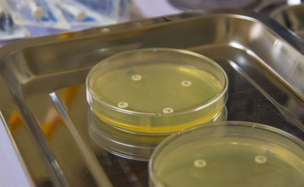 Культуральные исследования - Сеть клиник АО Семейный доктор (Москва) - Изображение 1