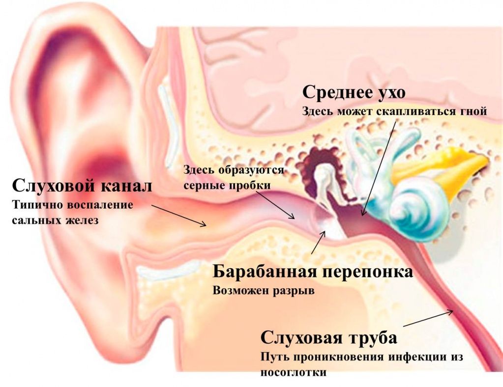 болки в ухото