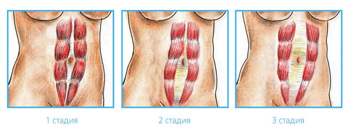 Рис. 1_700х277.jpg