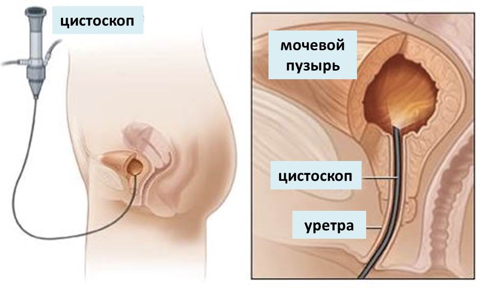 Изображение 1: Цистоскопия - клиника Семейный доктор