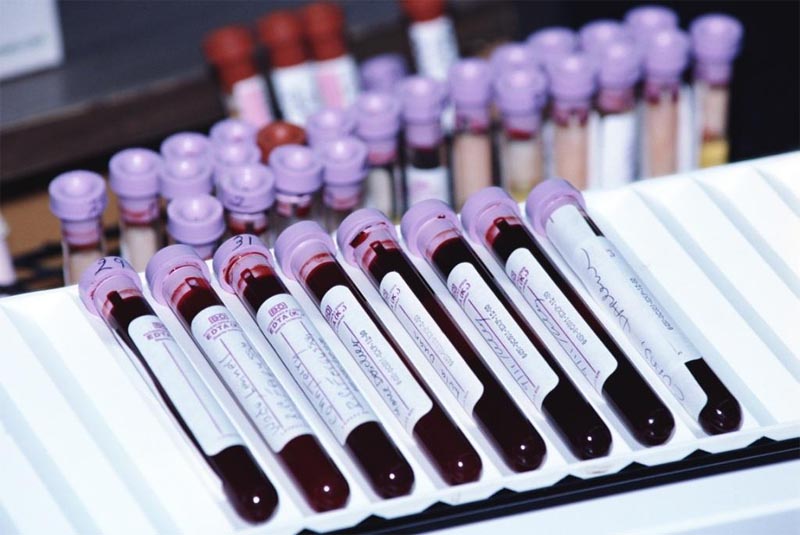 Изображение 1: Иммунологический анализ крови - клиника Семейный доктор
