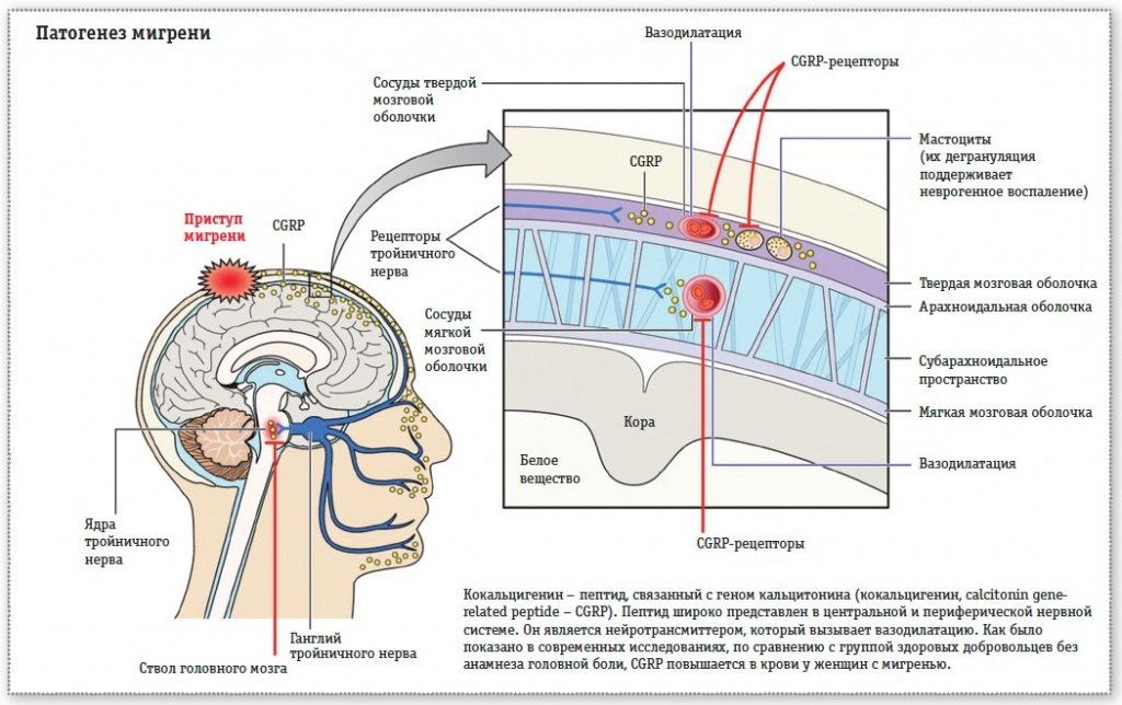 Все о мигрени - Сеть клиник АО Семейный доктор (Москва) - Изображение 4