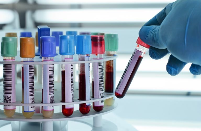 Биохимический анализ крови - Сеть клиник АО Семейный доктор - Фото 1