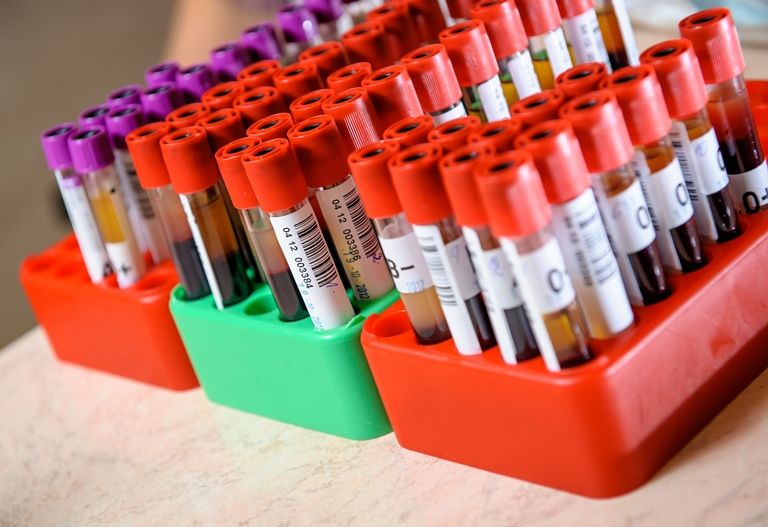 Анализ крови на онкомаркеры - Сеть клиник АО Семейный доктор - Фото 1
