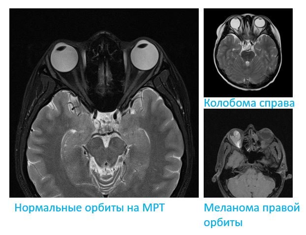 МРТ орбит. - Сеть клиник АО Семейный доктор (Москва) - Изображение 1