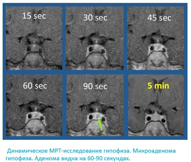 МРТ гипофиза - Сеть клиник АО Семейный доктор (Москва) - Изображение 2