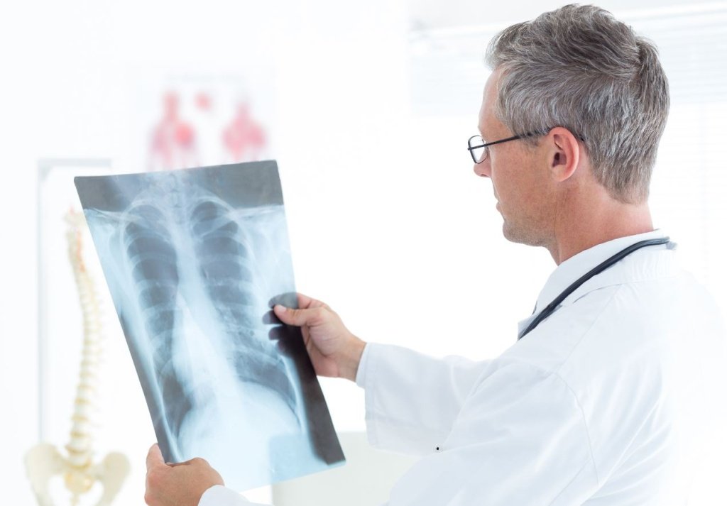 Пневмония - Сеть клиник АО Семейный доктор (Москва) - Изображение 4