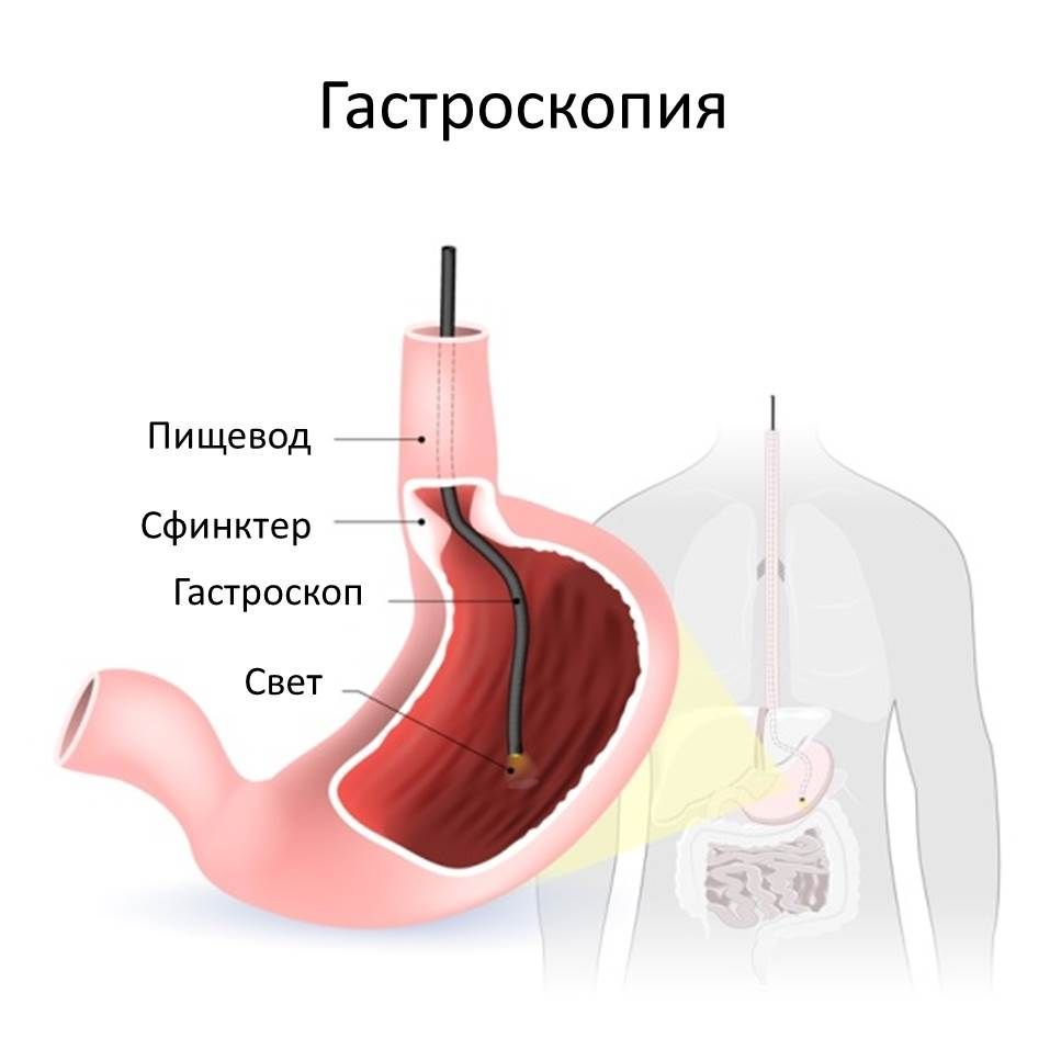 Гастроскопия - Сеть клиник АО Семейный доктор (Москва) - Рисунок 1