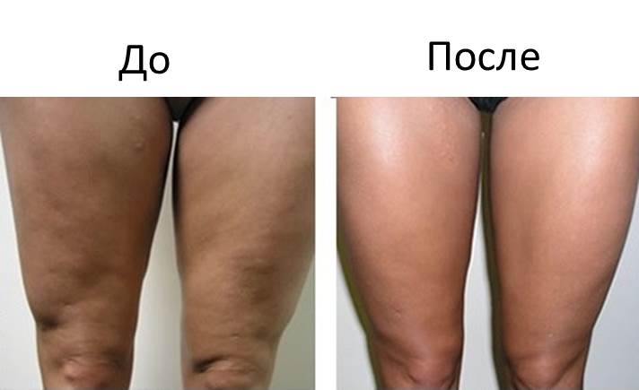 Изображение 3: Озонотерапия - клиника Семейный доктор