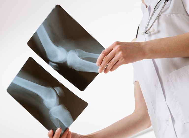 Рентген коленного сустава - Сеть клиник АО Семейный доктор - Фото 1