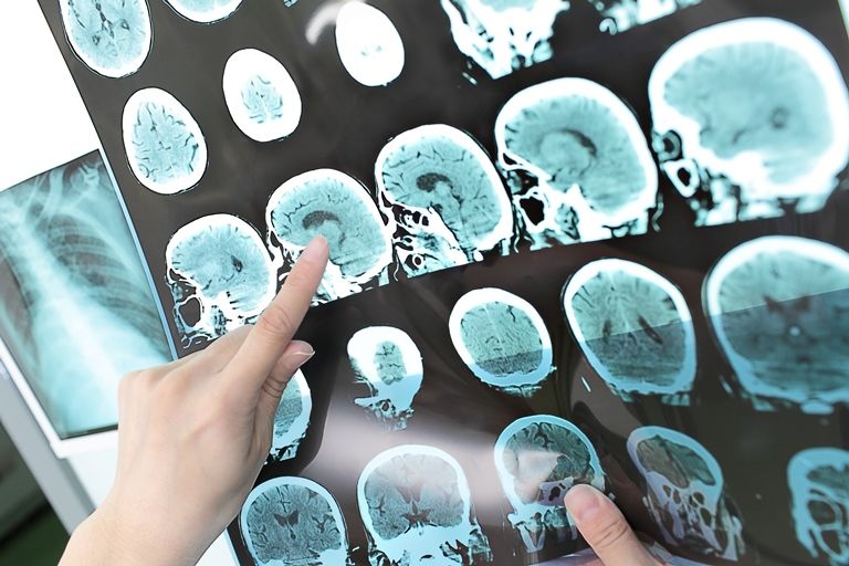 Компьютерная томография головного мозга - Сеть клиник АО Семейный доктор (Москва) - Фото 1