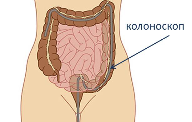 КОлосокпия в клиниках АО Семейный доктор Изображение 1