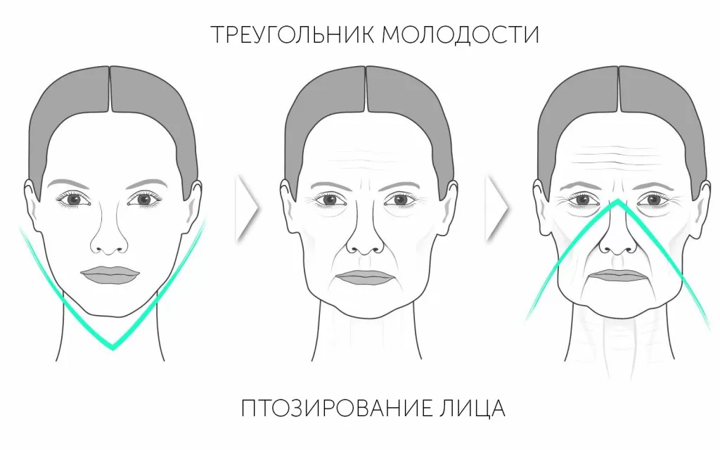 Круговая подтяжка лица - Сеть клиник Семейный доктор (Москва) - Изображение 2