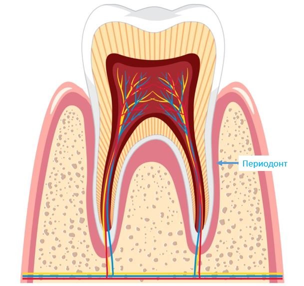 Периодонтит