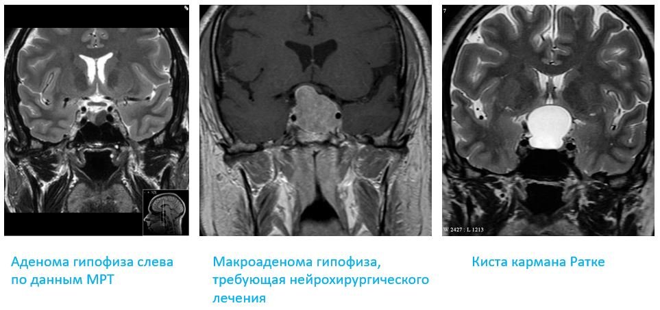 МРТ гипофиза - Сеть клиник АО Семейный доктор (Москва) - Изображение 1