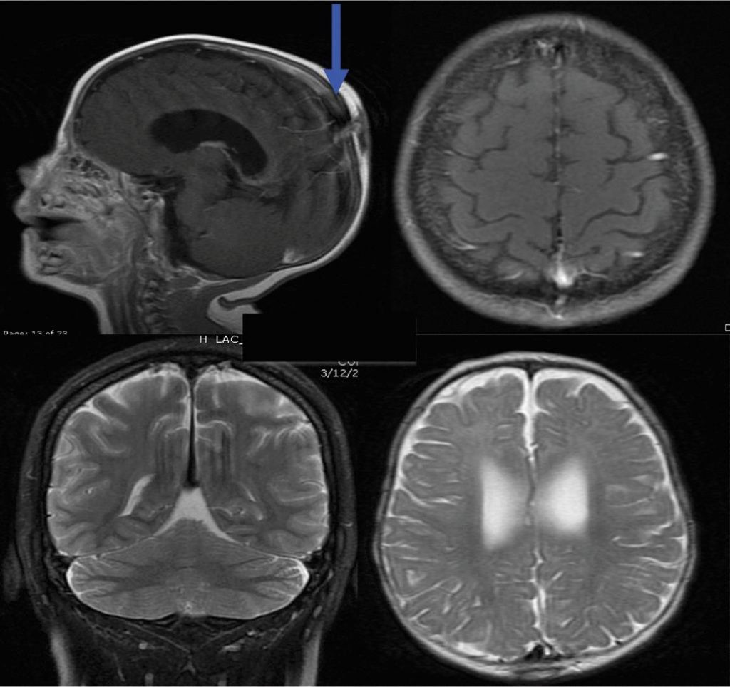 Изображение 1 - МРТ-томограмма головного мозга в разных проекциях - Клиника Семейный доктор