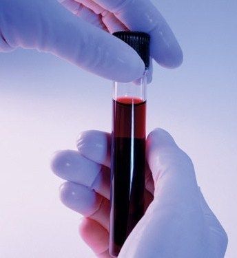 Изображение 1: Биохимический анализ крови - клиника Семейный доктор