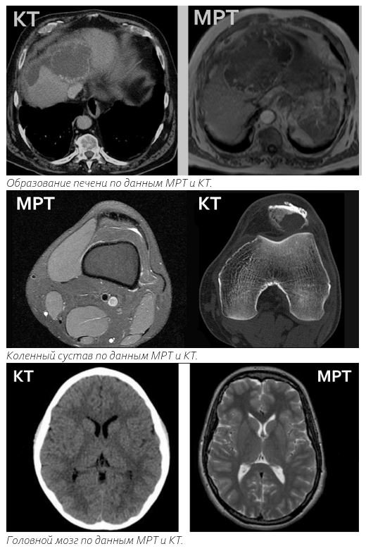 МРТ и КТ