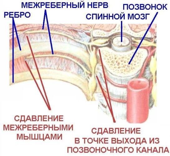 Межреберная невралгия - Изображений - Сеть клиник АО Семейный доктор