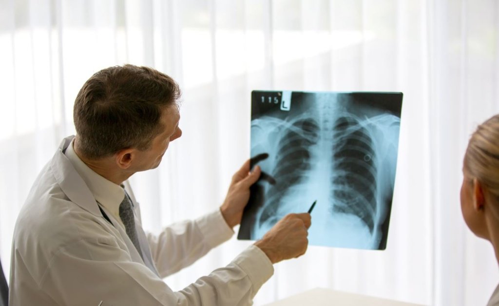 Флюорография или рентген легких - Сеть клиник АО Семейный доктор (Москва) - Изображение 1