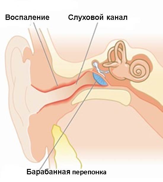 Острый и хронический отит: симптомы, лечение в Красноярске | Медюнион