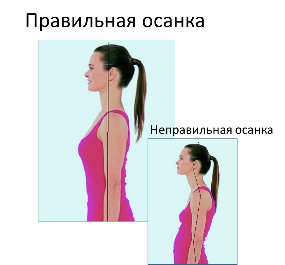 Изображение 3: Остеохондроз - клиника Семейный доктор