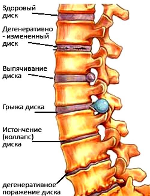 Изображение 1: Остеохондроз - клиника Семейный доктор