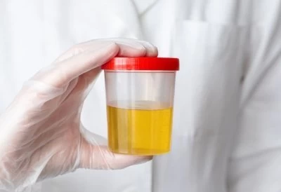 О чем говорит слизь в анализе мочи